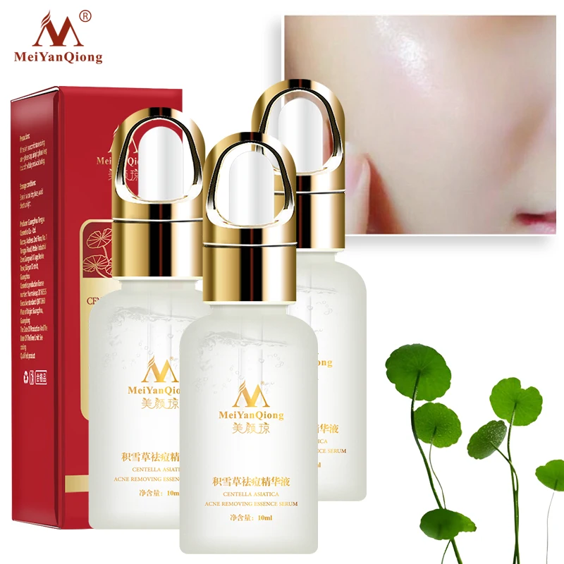 3 шт./lotMeiYanQiong Экстракт центеллы азиатской акне удаляет акне, устраняет следы акне, контролирует масла и отбеливает кожу 10 мл