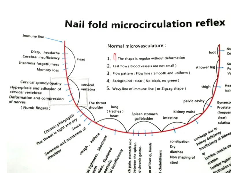 Nailfold капиллярный детектор микроциркуляции цифровой микроскоп микроциркуляция крови инструмент ЖК-дисплей опционально