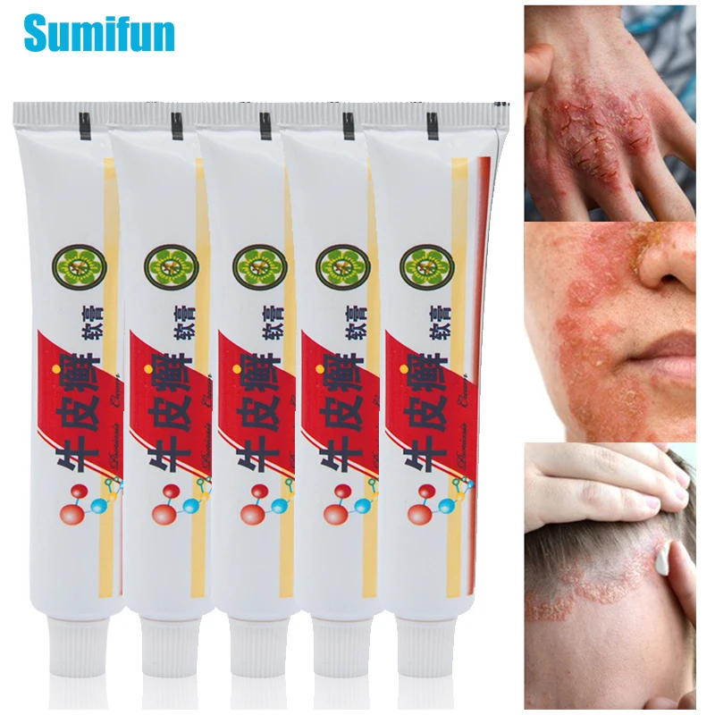 

3/5 шт., кремы Sumifun для псориаза, дерматит, экзема для тела, Псора, зуд, медицинский пластырь, травяная мазь P1018