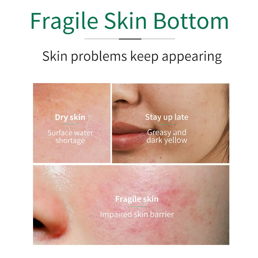 

Centella Soothing Face Serum Whitening Brighten Moisturizing Shrink Pore Anti Aging Anti Wrinkle Face Essence Skin Care 30ml