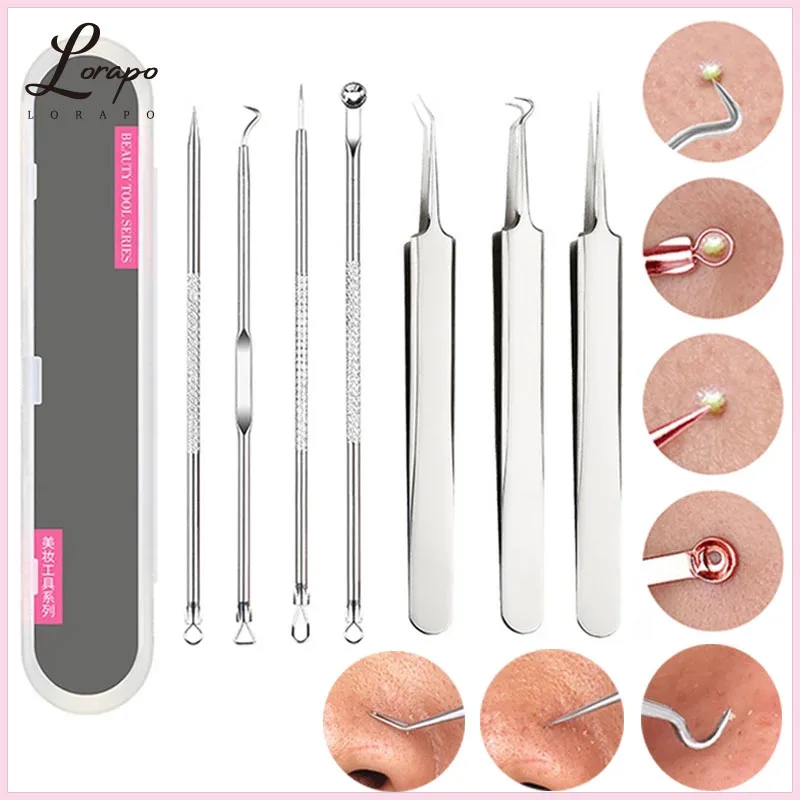 4 шт. инструменты для удаления чёрных точек акне прыщей|Устройство ухода за кожей