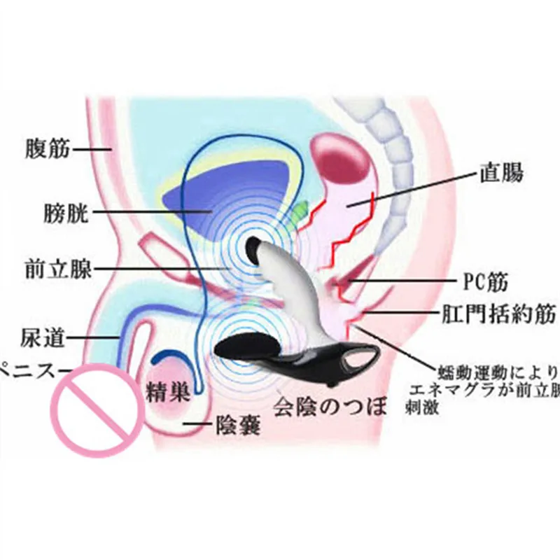 Электроимпульсный массажер простаты стимуляция электрическим током терапия