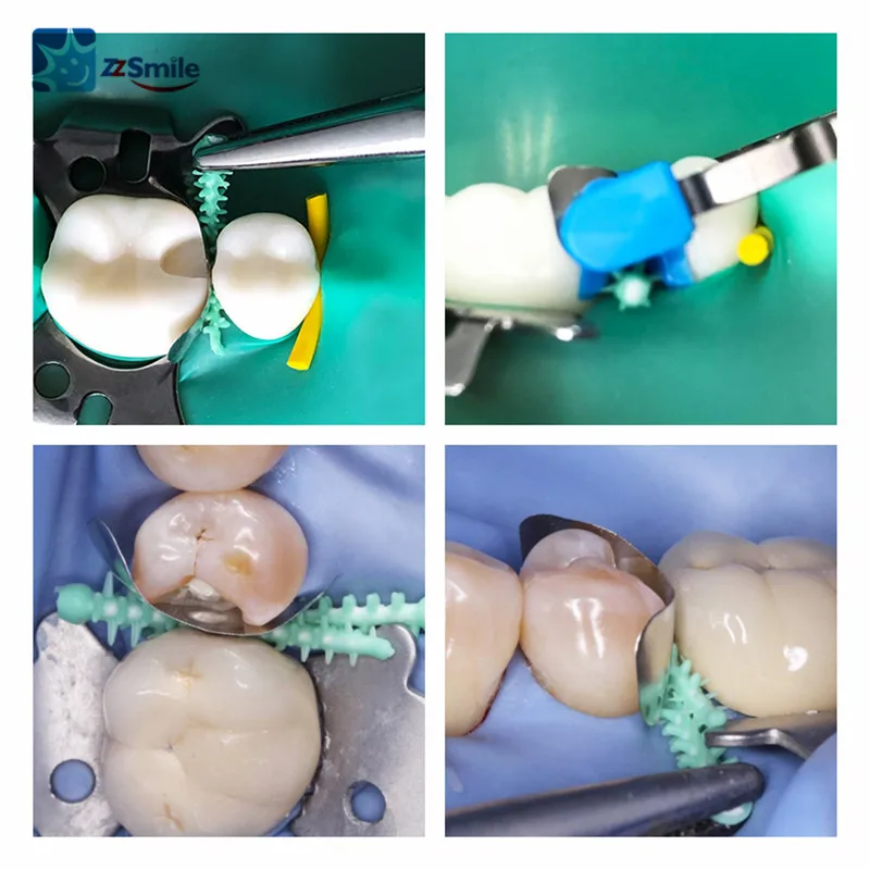 

Dental Silicone and Plastic Adaptive Interdental Wedges