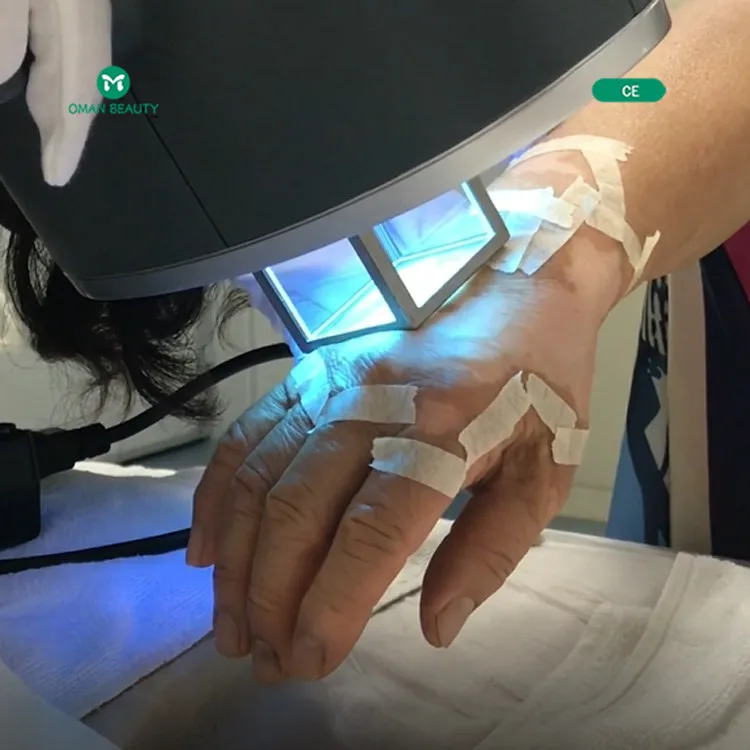 2021 sales 308nm excimer lamp target uv phototherapy device for skin disorders treatment psoriasis light vitiligo |
