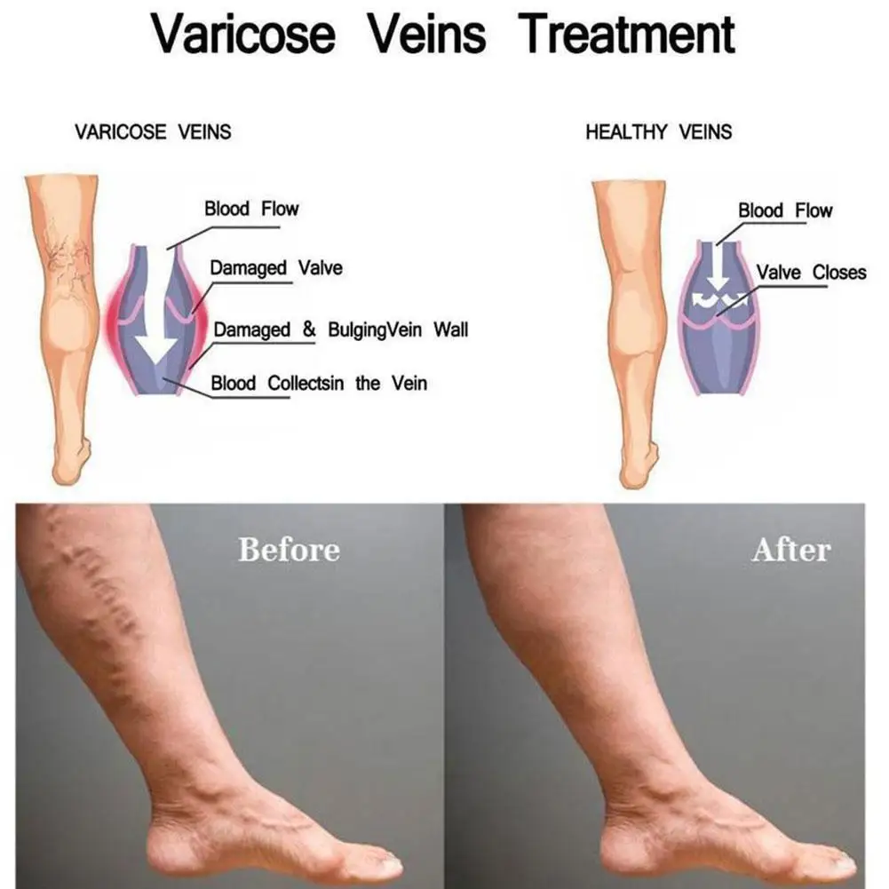 

Pumice Sponge Stone Stone Grinding Foot Stone Clean Supply Cocoons Footcare Clean Dead Beautiful Make Massage Grinding Feet M5K5