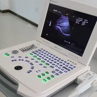 instrumento de diagnostico digital escaner de ultrasonido doppler a color