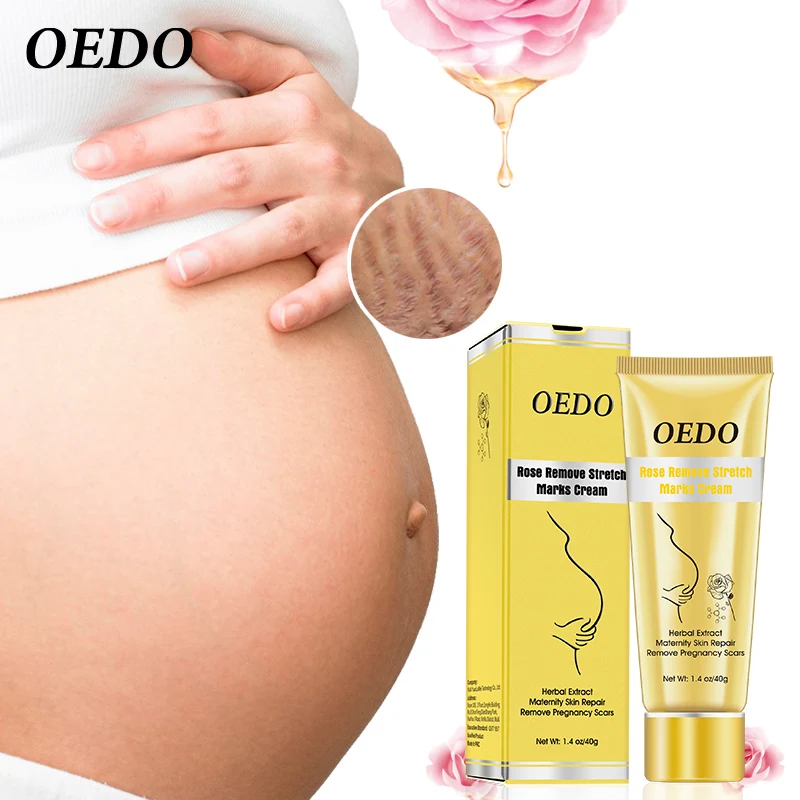 Крем для устранения растяжек и ожирения после родов антивозрастной укрепляющий