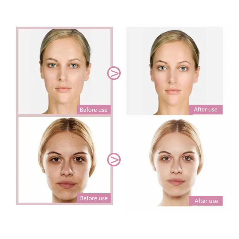 Домашний прибор для омолаживания кожи RF ухода за кожей лица радиочастотный