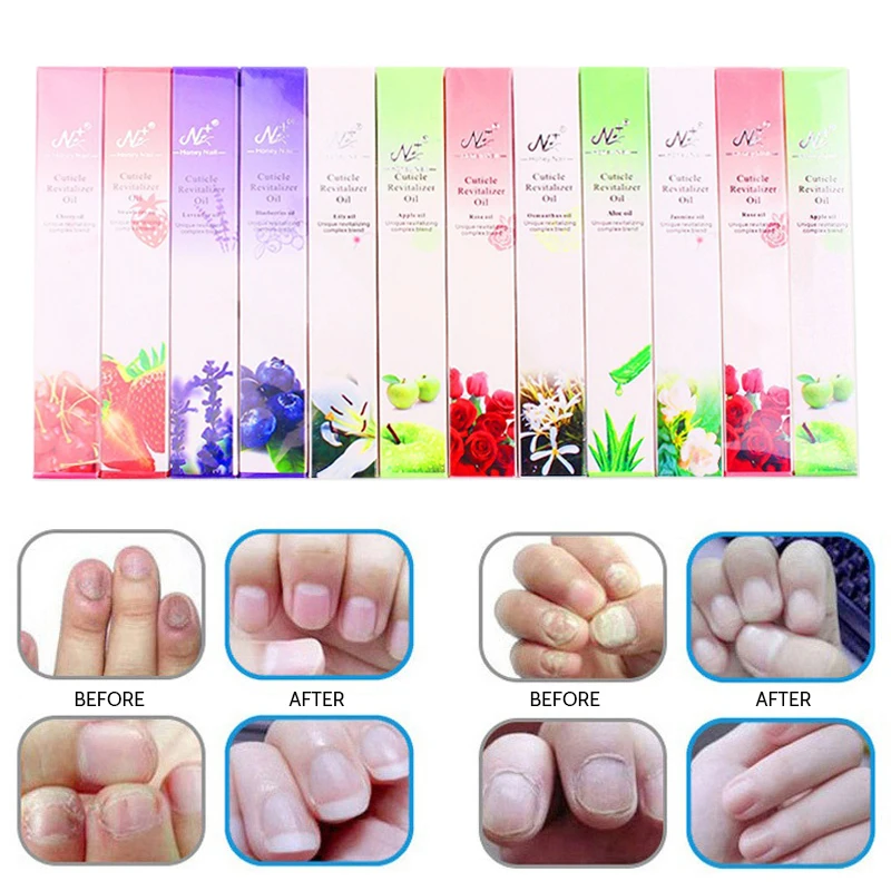

1/3/5PCS New 5ML Liquid Anti Nail Toenail Fungus Nail Care Pen Cuticle Oil Pen Nails Care Solution Nail Treatments Tool TSLM2