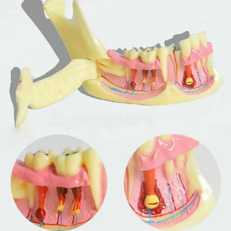 

1pcs Dental Low Jaw Jawbone Tissue Mandible Anatomical Model Study Teach Clinic