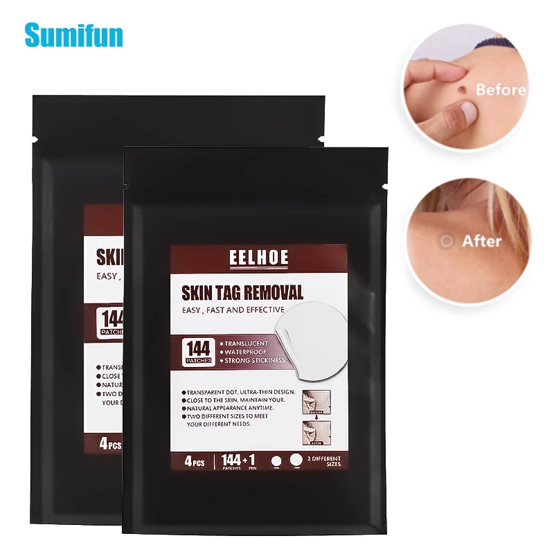 

144Pcs/bag Wart Remover Patch Mole Skin Sticker Cure Dark Spot Filamentous Calluses Wart Painless No Scar safe effective