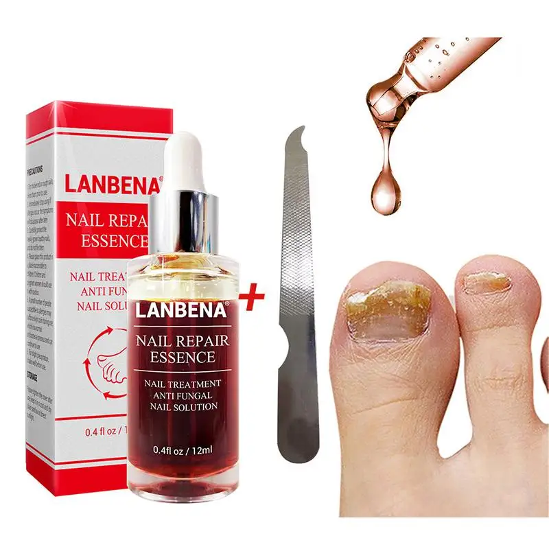 Новый 12 мл Лечение грибка ногтей с напильником анти Грибное удаление онихомикоза