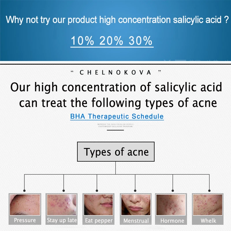 

Salicylic acid 10% bha Chemical peel Scrub Remove Whellote-head Papular acne detail Pustules acne Pustules Comedones Cystic