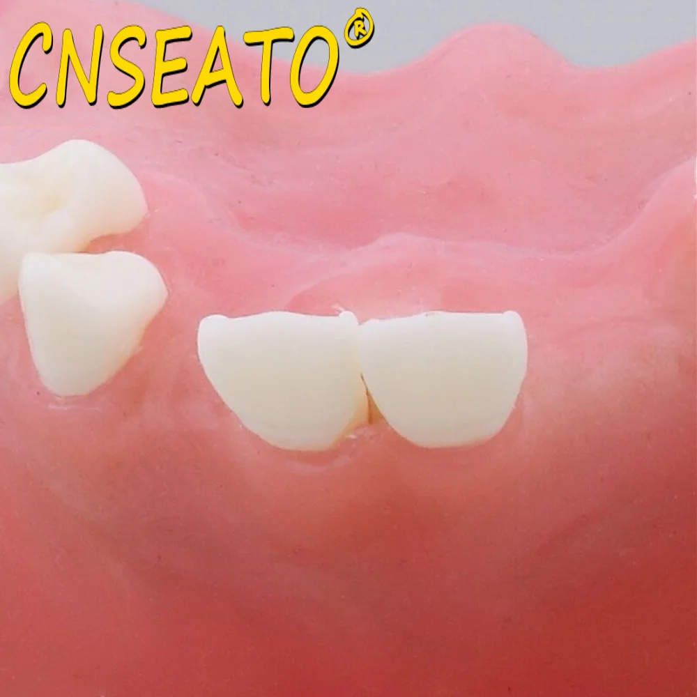 Стоматологическая модель зубов зубной тренажер для тренировки подъема кости в