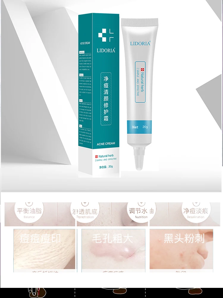 

Acne cream Remove acne marks Acne Acne scars student acne Blackhead acne Whitening Lighten spots Shrink pores