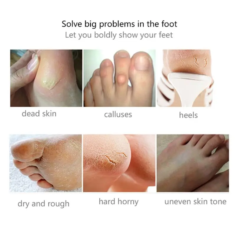 

Rose Flower Extract Foot Peeling Mask Exfoliating Remove Dead Skin Sock Pedicure Cuticles Crack Heel Repair Moisturizing