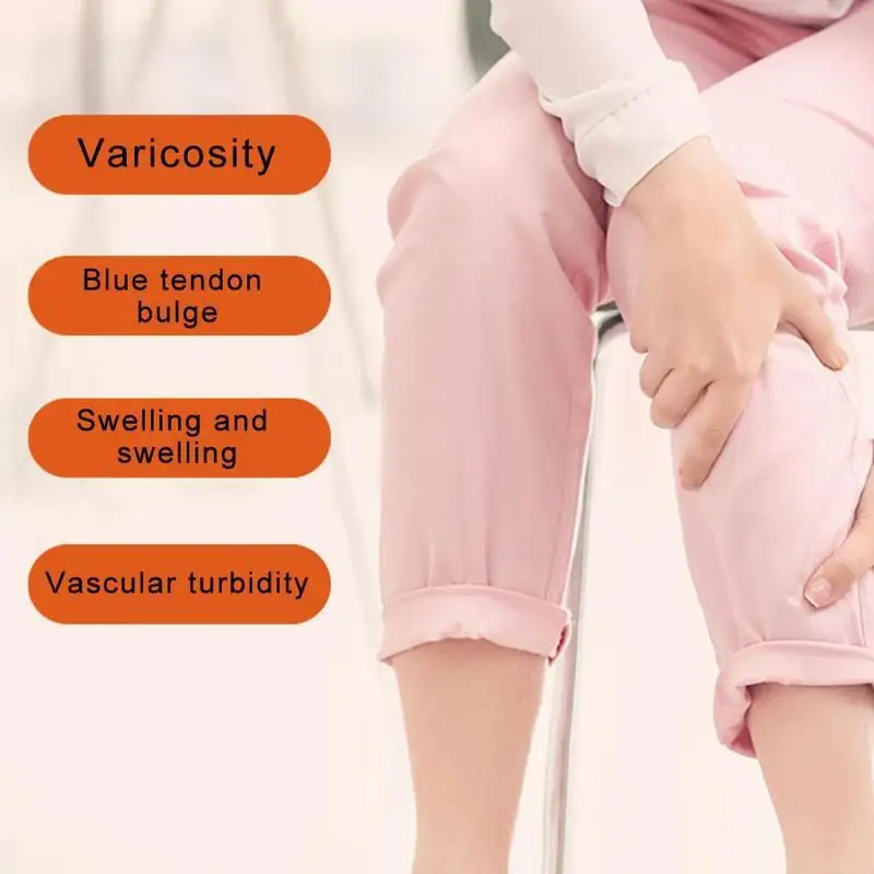 

Varicose Veins Cream Of Varicose Veins Medical Spider Chinese Ointment Veins 20g Herbal Varicose Medicine Veins Treatment J1A6