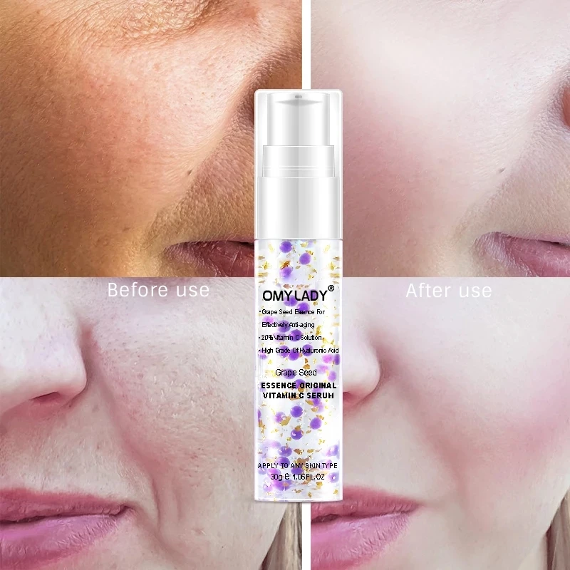 

Omy LADY Snail Repair Face Cream With Grape Seed Essence Original Vitamin C Serum Cream Moisturizing Anti-wrinkle Facial care