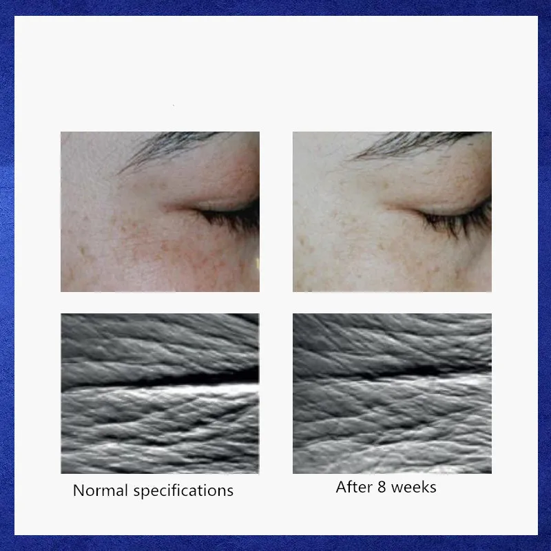 

Astaxanthin essence helps to repair light wrinkles, brighten skin tone, moisturize and resist old age.