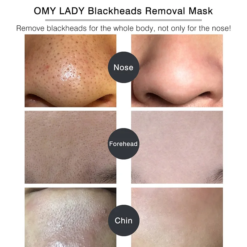 Men Women Blackhead Remove Face Mask Bamboo Charcoal Peel Off 30g KG66 |