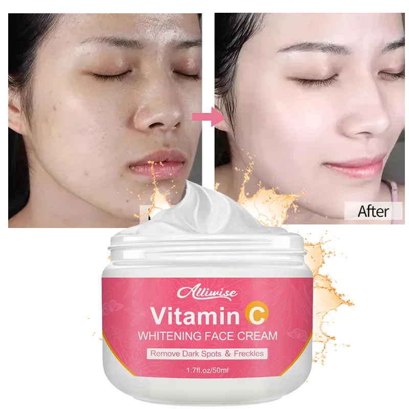 

Alliwise Vitamin C 25% Face Cream Whitening Remove Dark Spots Facial Repair Fade Freckls Melanin Clear Brighten Skin Care 50ml