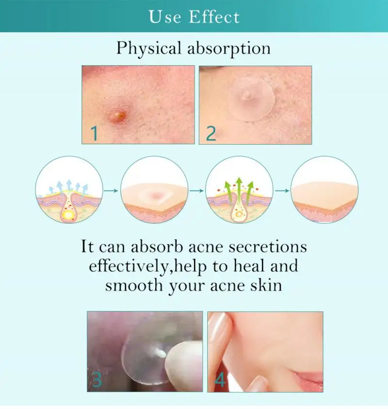 FTEENPLY Acne Pimple Patch Invisible Acne Removal Acne Treatment Sticker Blemishing Spot Waterproof Breathable Face Skin Care