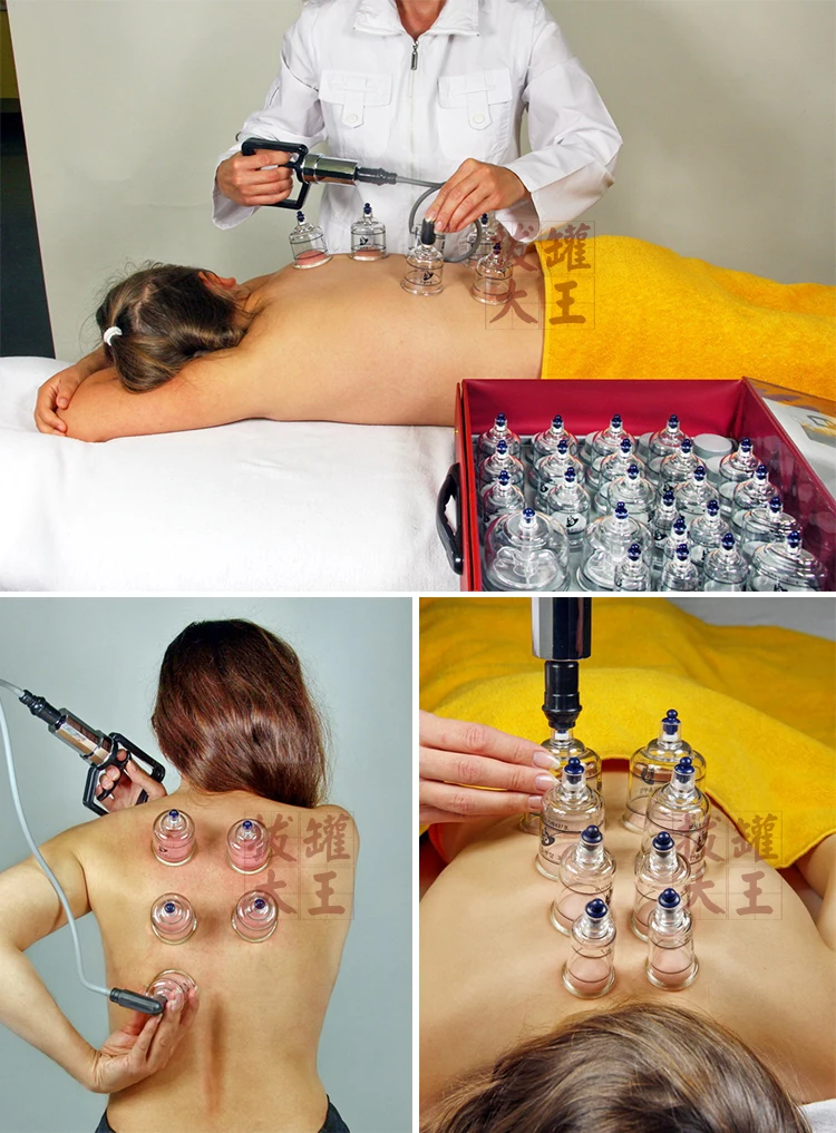 Высококачественный резервуар бытовые вакуумные банки 19 банок для стаза крови