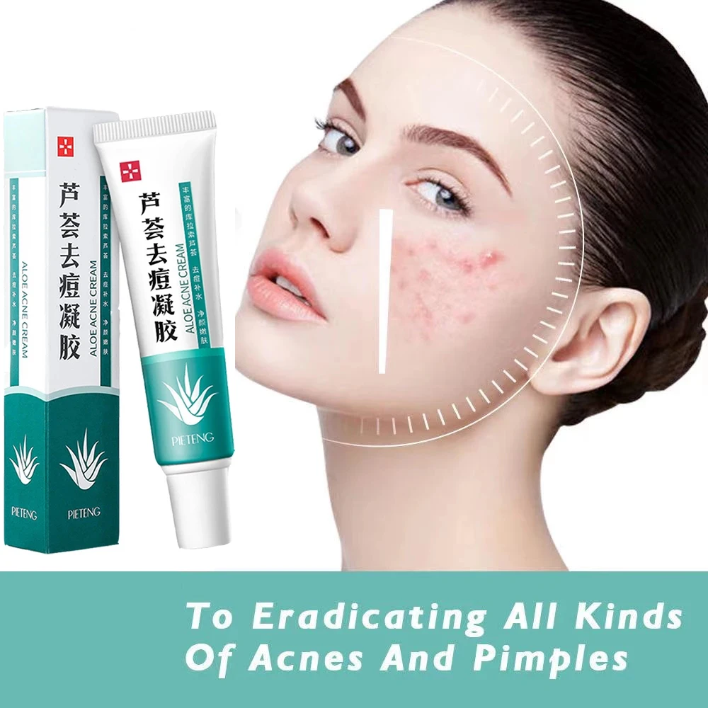 Эффективный крем для удаления акне лечение увлажнение отбеливание уход за