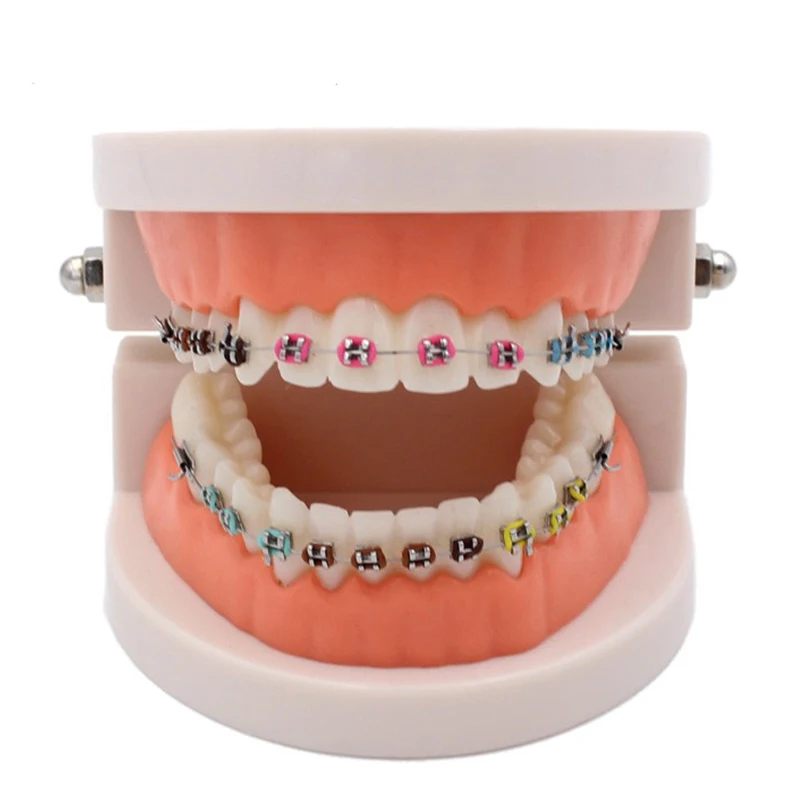 1 шт. Стоматологическая модель зуба с кронштейном Ортодонтическая обучающая