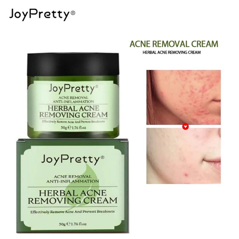 

JoyPretty Acne Remover Cream Herbal Pimple Acne Treatment Face Cream Cleansing Moisturizing Korean Skin Care Cosmetic
