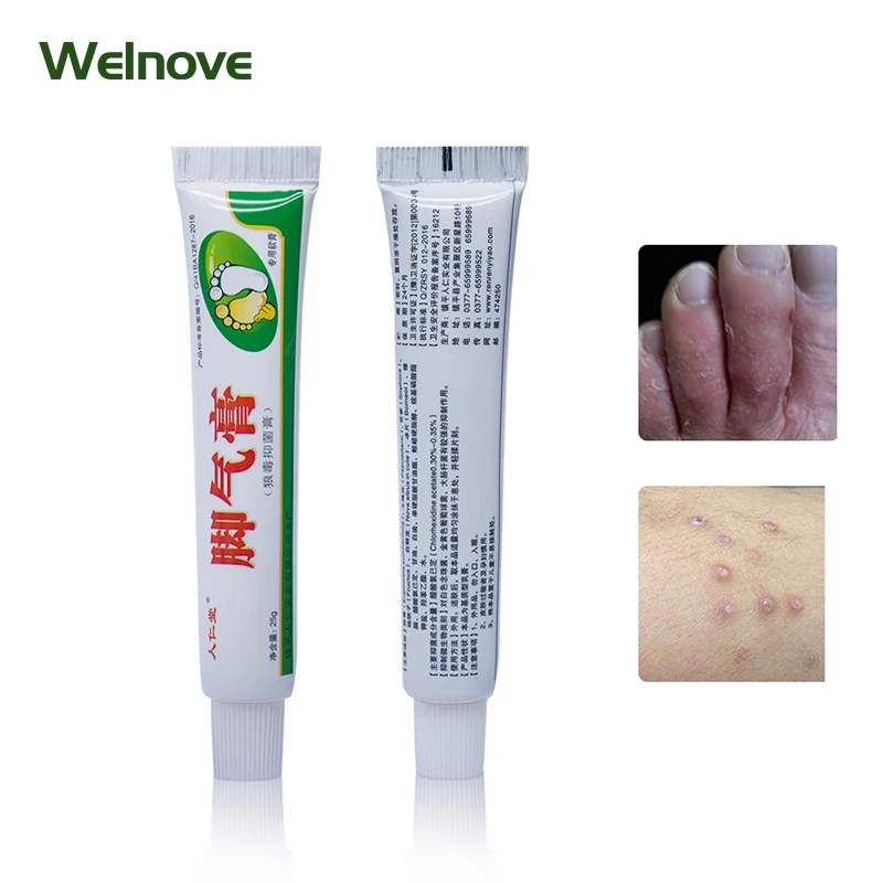 

Athlete's Foot Relief Cream Erosive Beriberi Anti Itching Sweat Odor Feet Psoriasis Pain Patch Antibacterial Ointment Foot Care