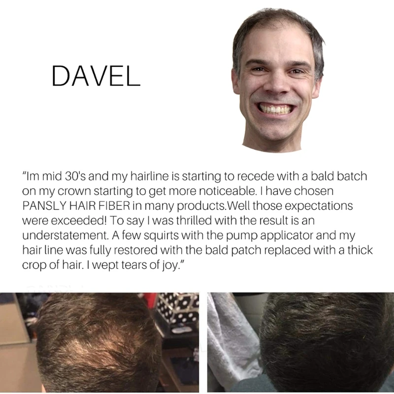 Аппликатор для волос 27 5 г потеря пудра наращивания утолщение спрей темно