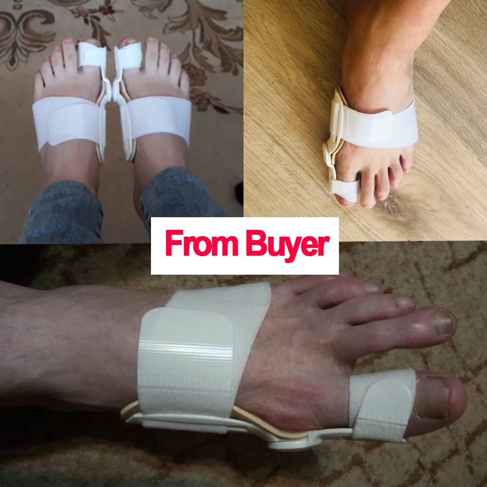 Foot для большого пальца стопы можно устройство, корректор исправление вальгусной деформации первого пальца стопы ортопедической брекеты большой коррекция носка ноги с накатанной головкой уход корректор Ортопедия большой кости