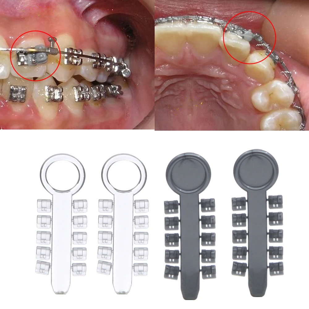 

100Pcs/pack Professional Orthodontic Dental Brackets Rotation Wedge Clear Gray Rotary Pads Orthodontic Elastic Rotation Wedges
