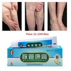 Крем для лечения варикозного расширения вен, мазь для васкулита, ангиита, флебита, лечение боли в венах, травяной крем для тела, Прямая поставка