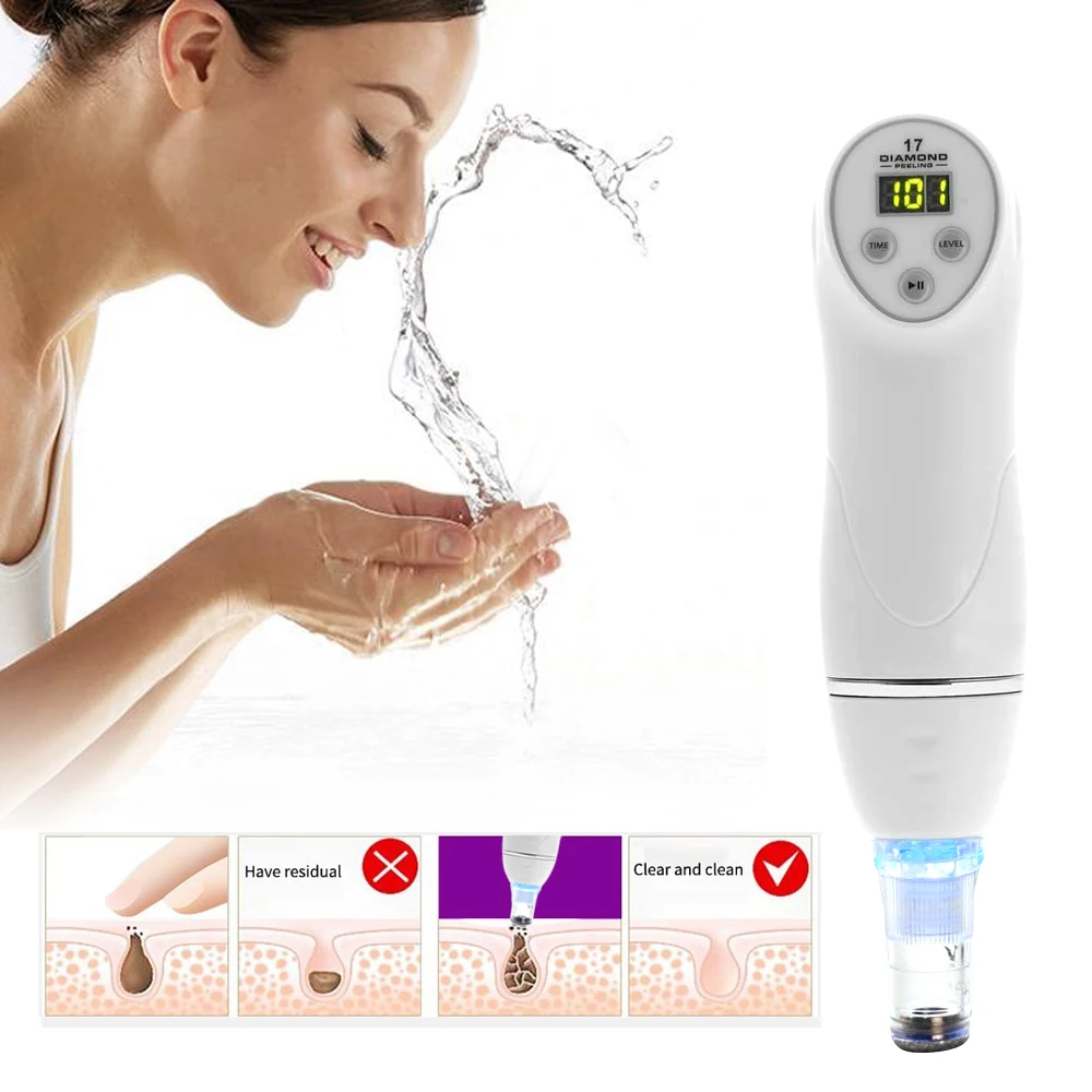 

Microdermabrasion Diamond Peeling Blackhead Remover Face Pore Acne Pimple Removal Blackhead Extractor Facial Vacuum Cleaner