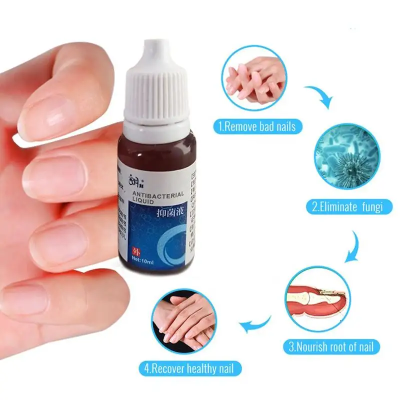 1 бутылка грибковые заболевания Уход за ногтями жидкость для удаления светлых
