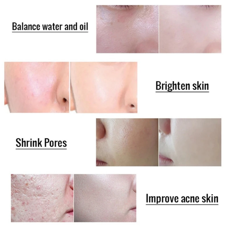 30 мл сыворотка с гликолевой кислотой для ухода за кожей лица омолаживающий