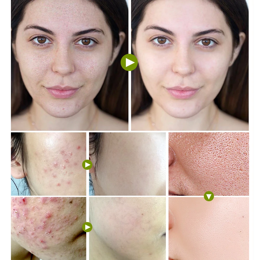 

Skin Care