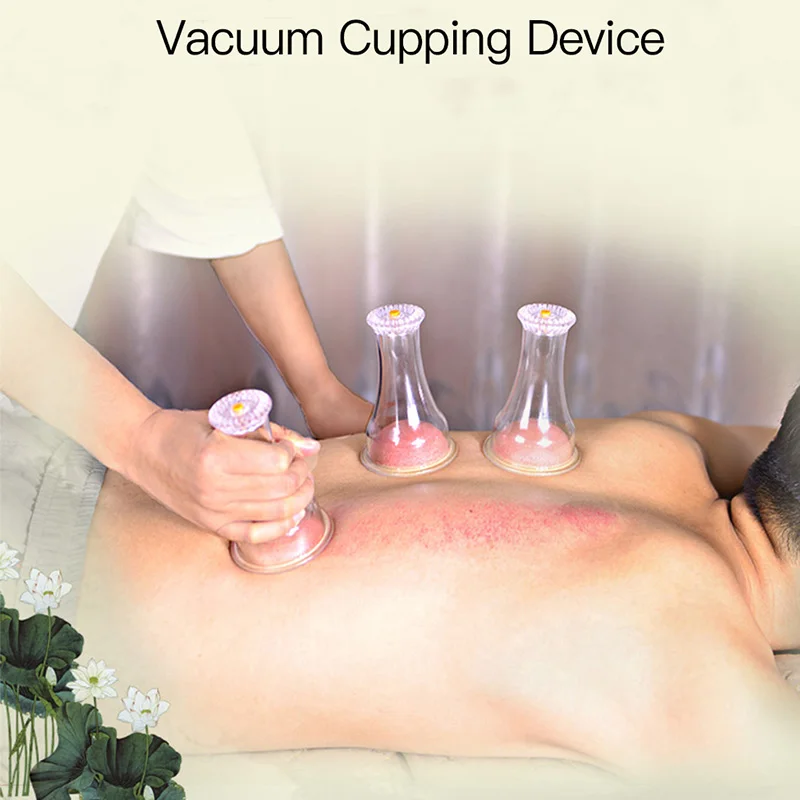 1 Set Vacuum Cupping Device For Household Cupping And Scraping Exhaust The Cold Get Rid Of Chill Device