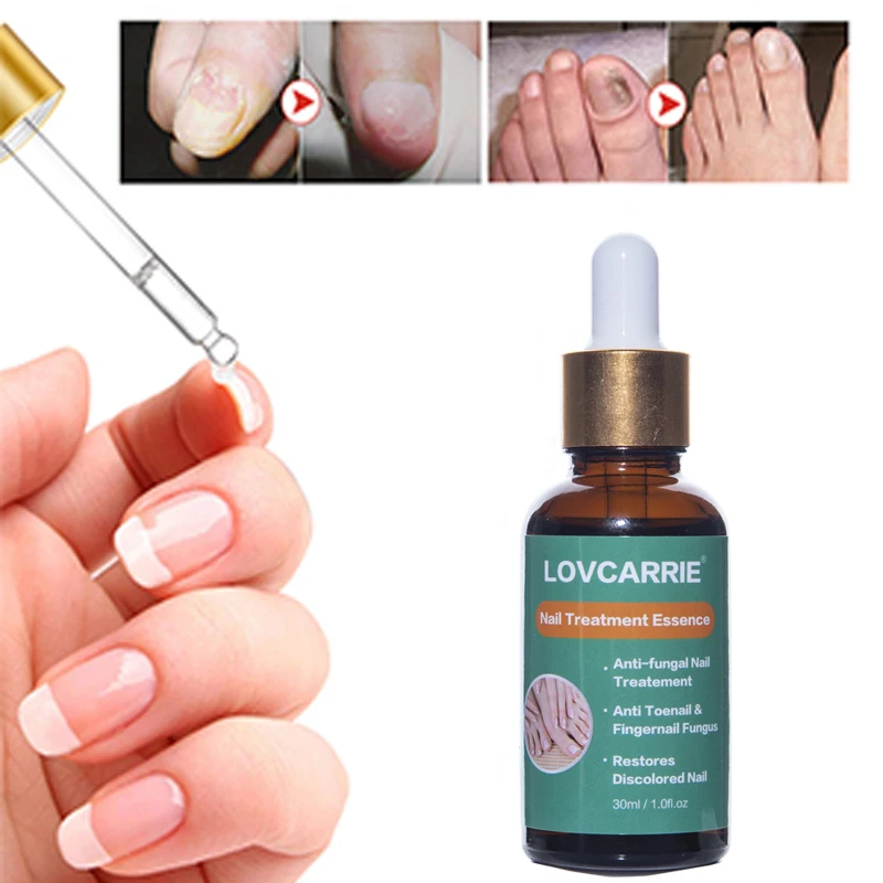 Жидкость для удаления кутикулы ногтей 2 шт./компл. 30 мл|Средства ухода за ногтями| |