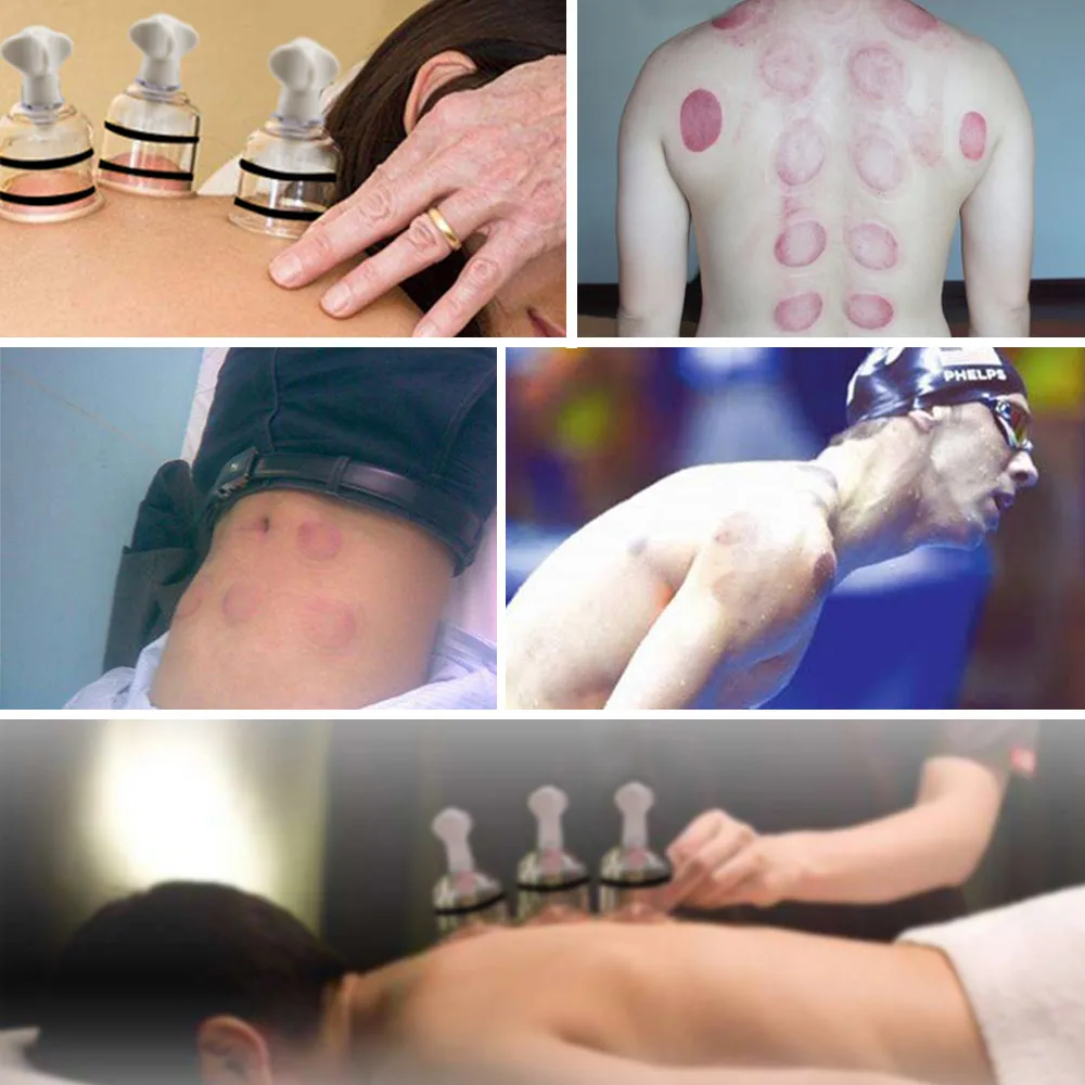 2 шт. банки для вакуумного массажа тела с вращающейся ручкой | Красота и здоровье