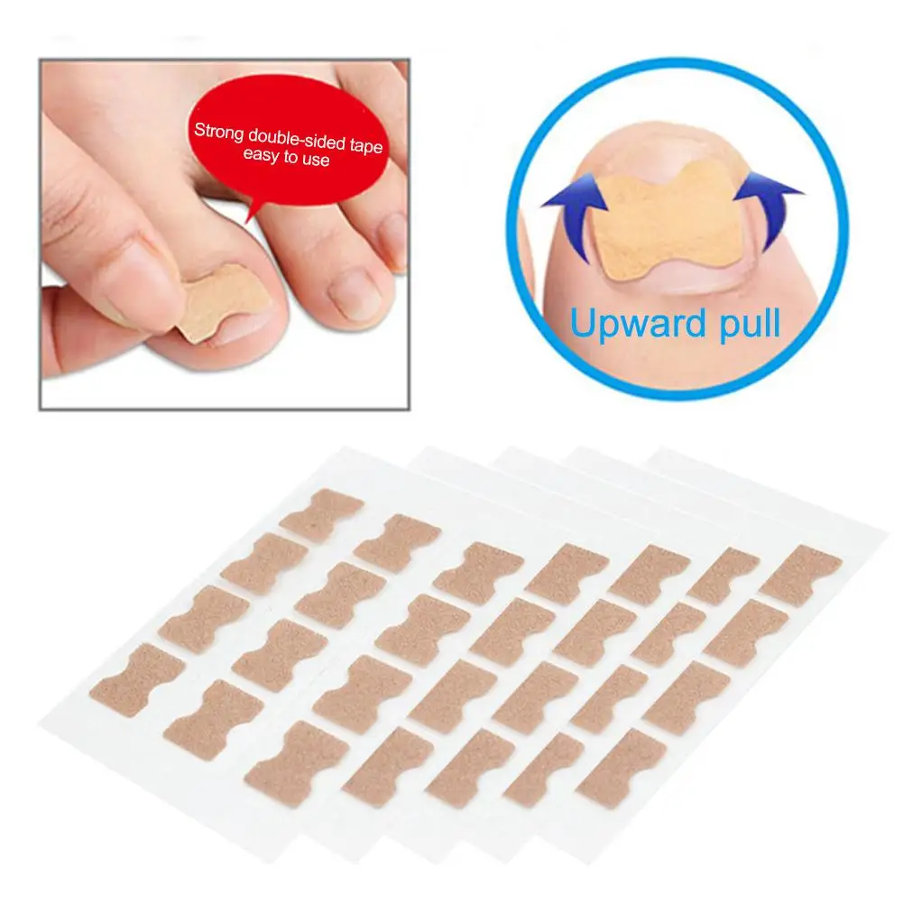 10 шт. вросший корректор для ногтей стикер лечения пароникья восстановления