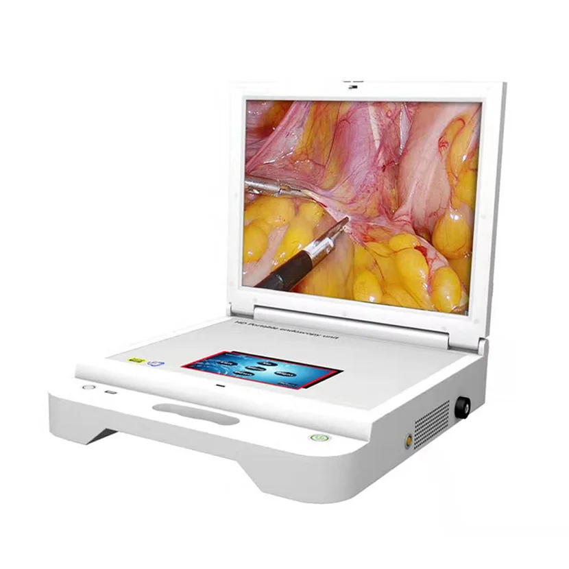 

MY-P038B medical endoscope 17 inch HD LCD screen portable endoscopic camera