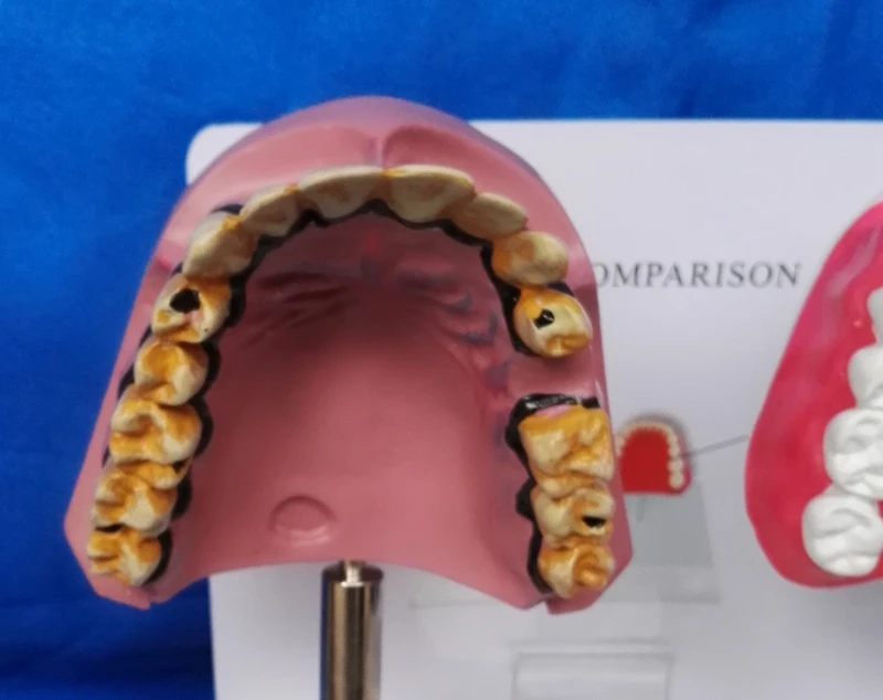 Модель зуба для кормления медицинская модель ухода за зубами обучения курению