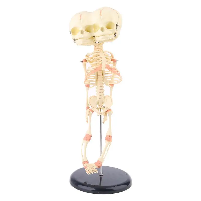 

37cm Human Double Head Baby Skull Skeleton Deformed Head Skull Research Model Anatomy Brain Display Anatomical Model