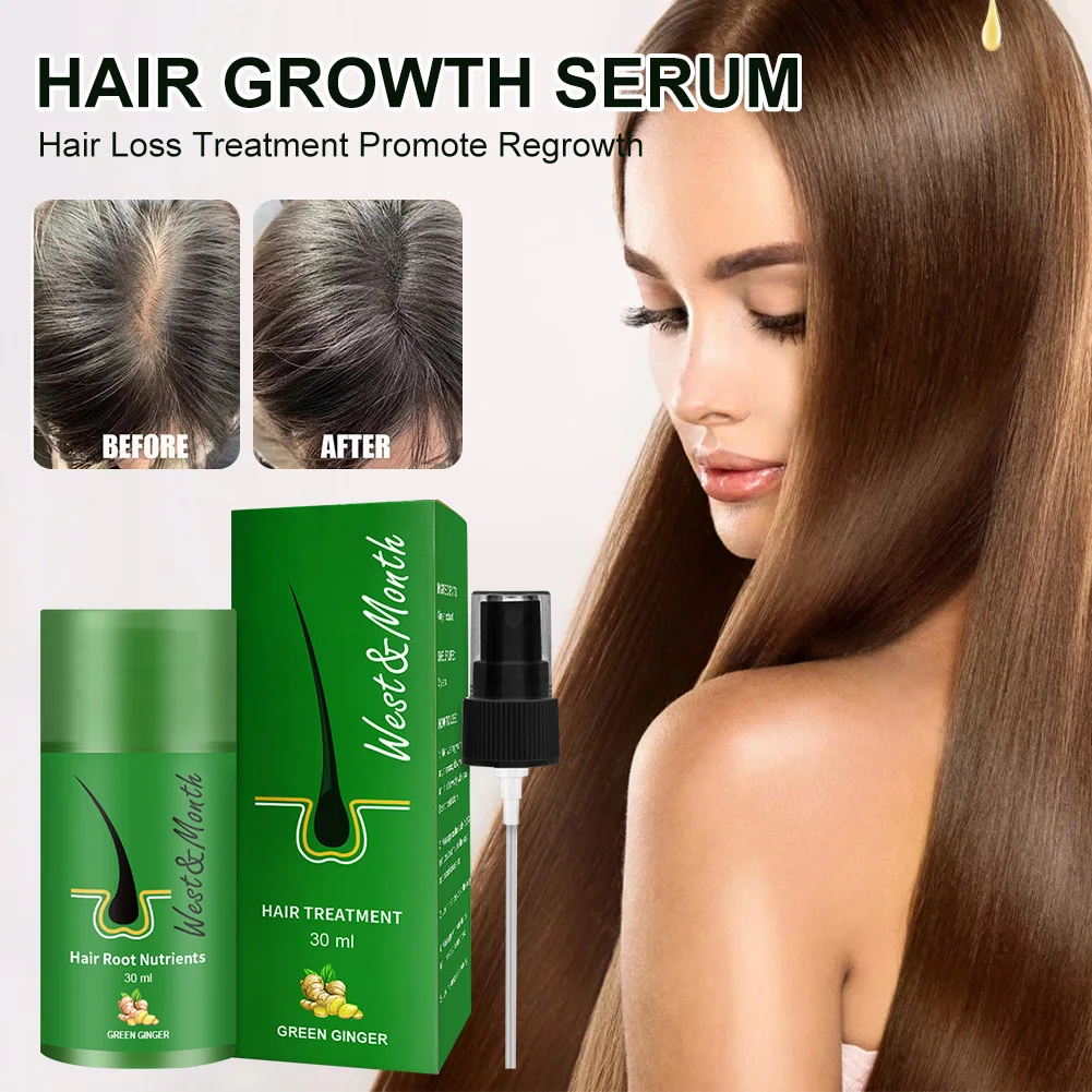 

Ginger Hair Growth Essential Oils Promote Hair Regrowth Essence Prevent Baldness Hair Loss Hair Serum Repair Damaged Hair Care
