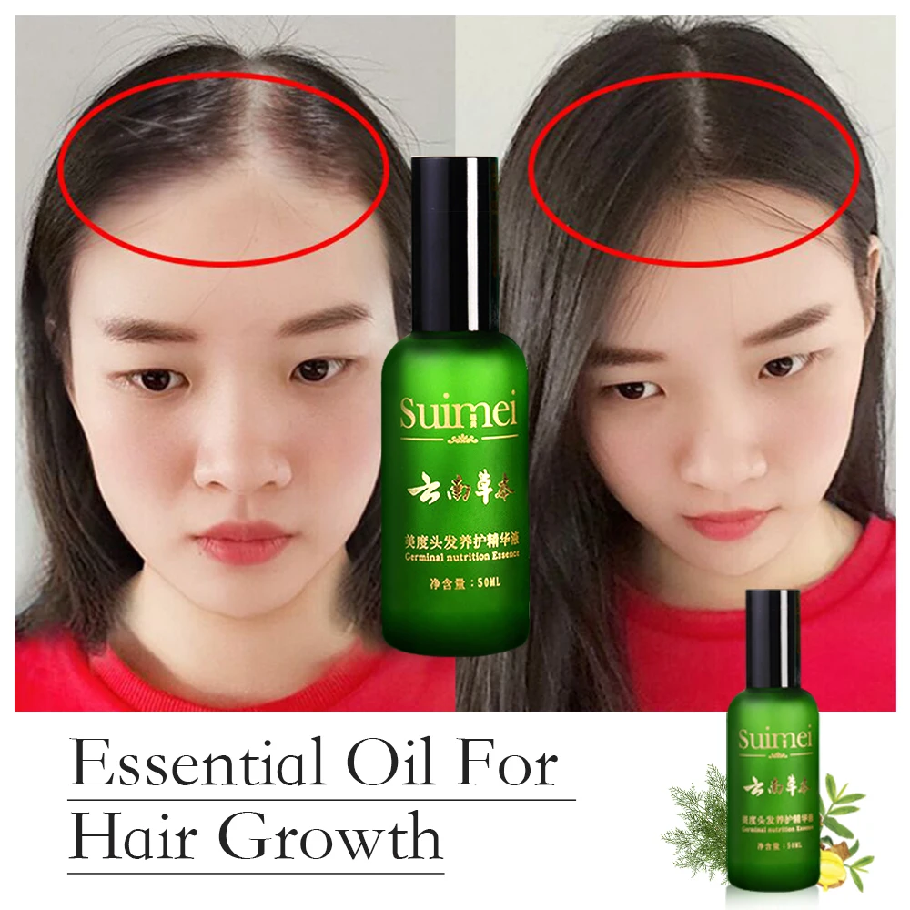 Сыворотка для роста волос эфирное масло против выпадения устранение повреждений