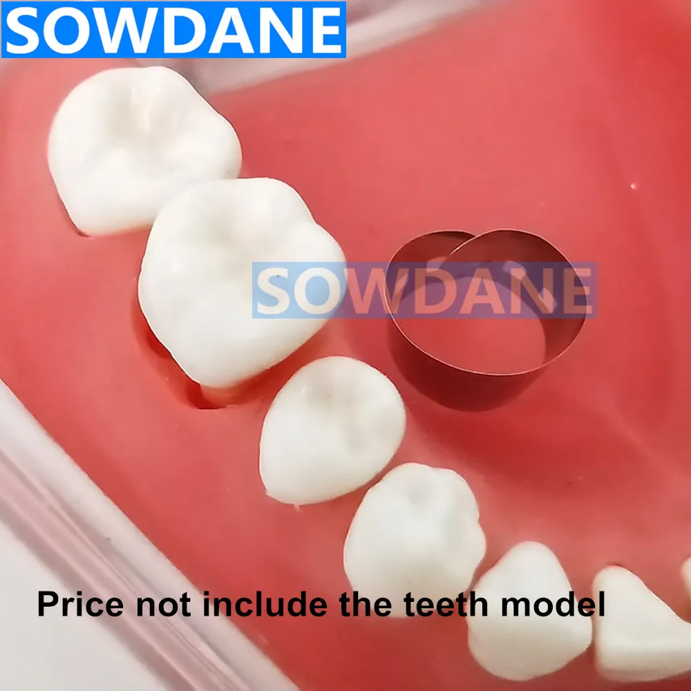 10 ⑤ кор. зубные Близнецы молярные матрицы Стоматологические Ортодонтические