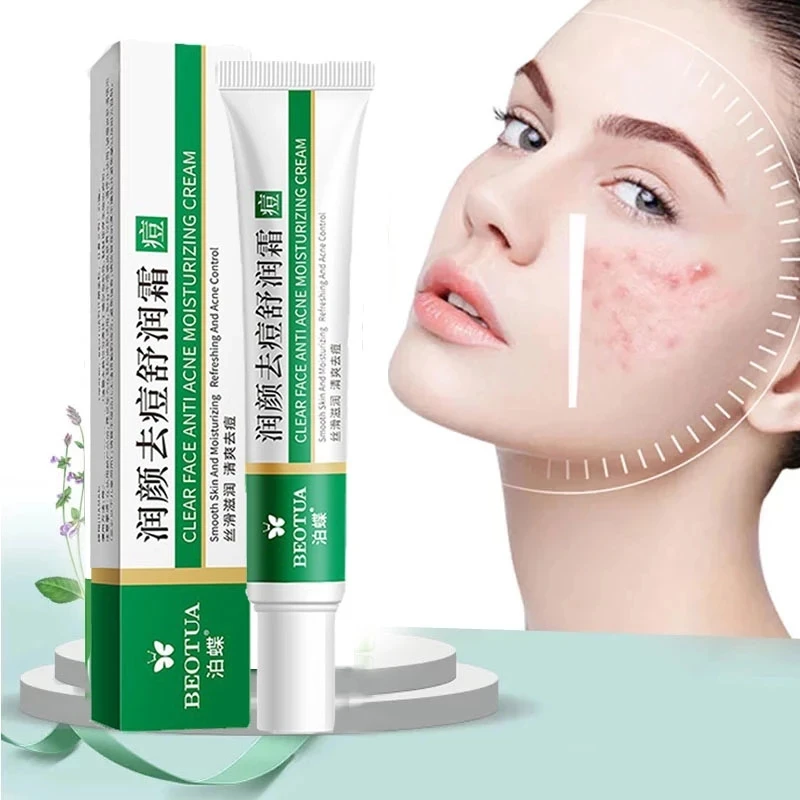 

Effective Acne Removal Cream Anti-acne Repair Fade Acne Spots Oil Control Whitening Moisturizing Face Gel Skin Care 20g